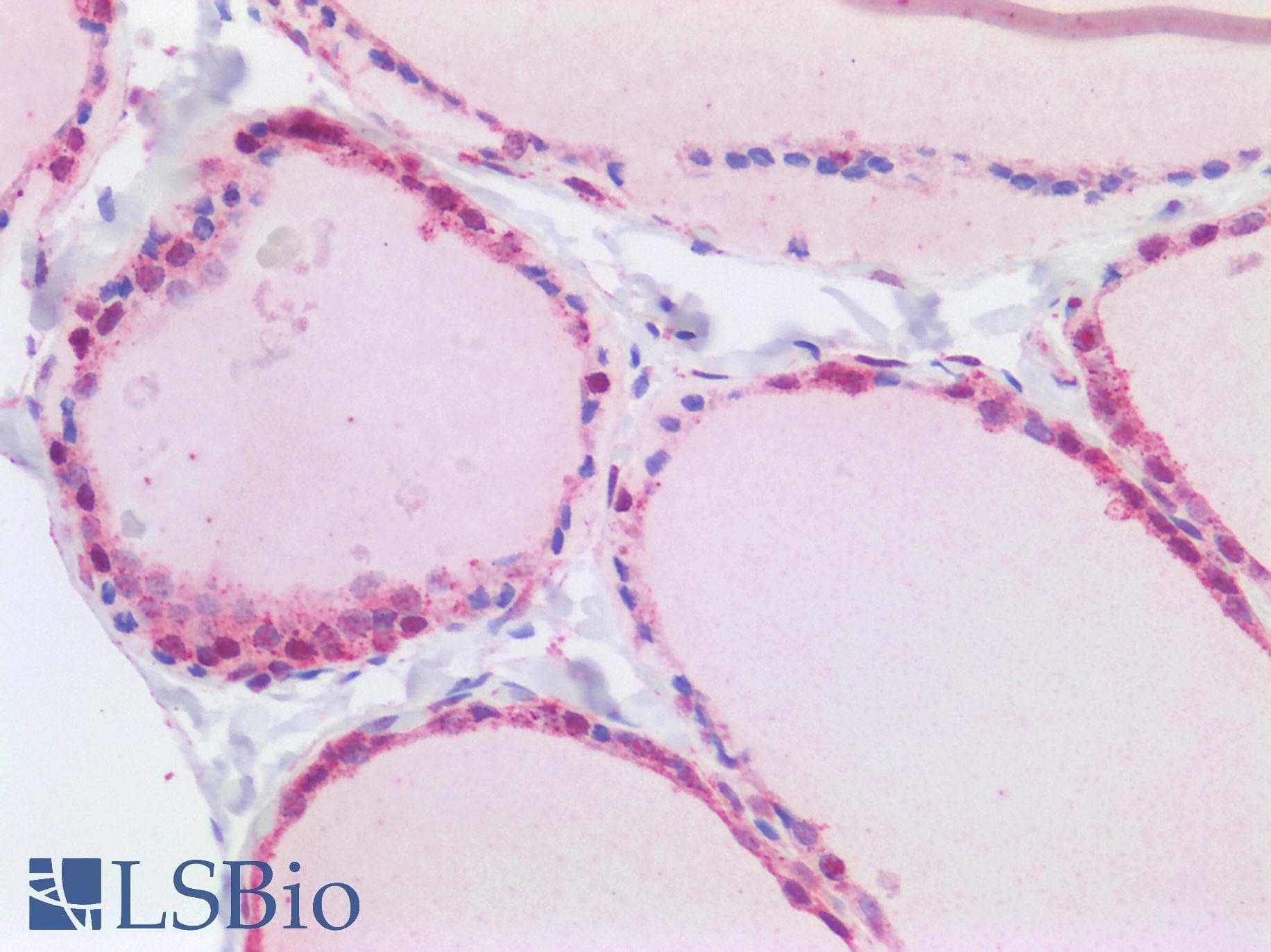 Polyclonal Rabbit anti-Human RALGAPB / KIAA1219 Antibody (aa1025-1075, IHC, WB)