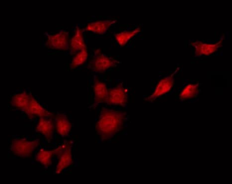 CaMKII Alpha+Beta+Delta Antibody (aa516-542)