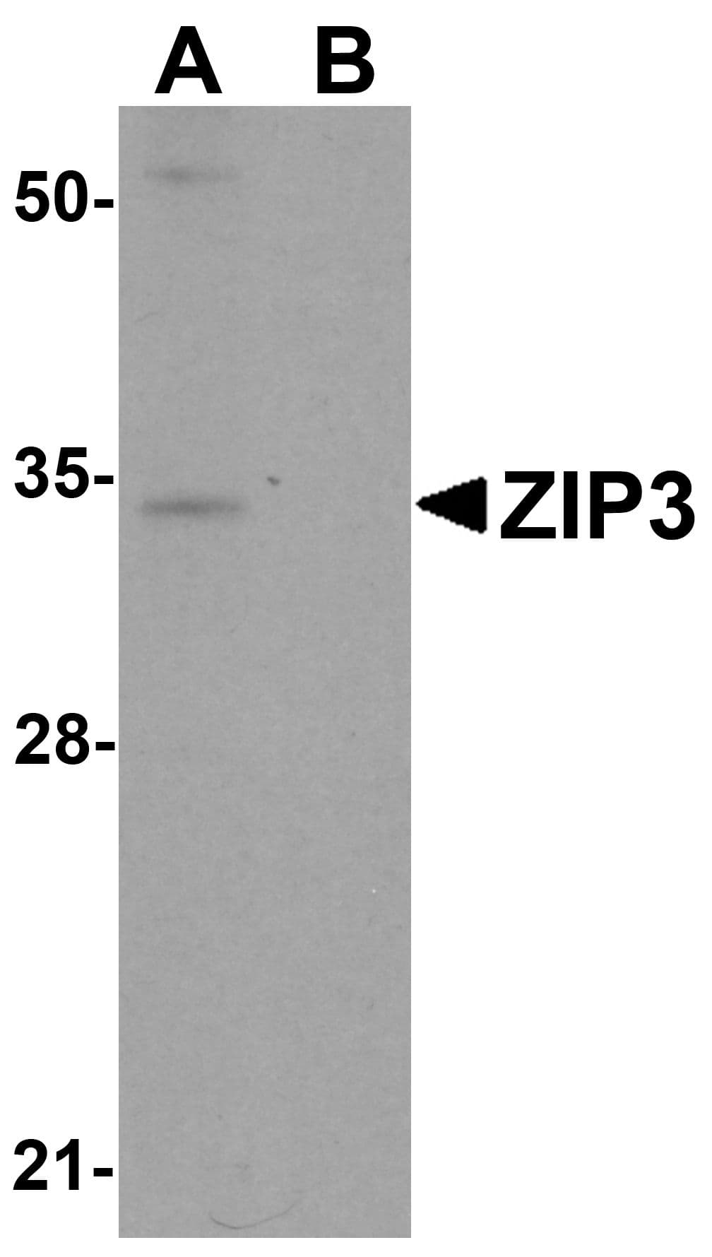 IHC-plus™ SLC39A3 / ZIP3 Antibody