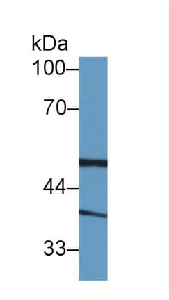 BLVRA Antibody (aa1-125, Biotin)