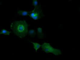 PIK3C2B Antibody (clone OTI2G3)
