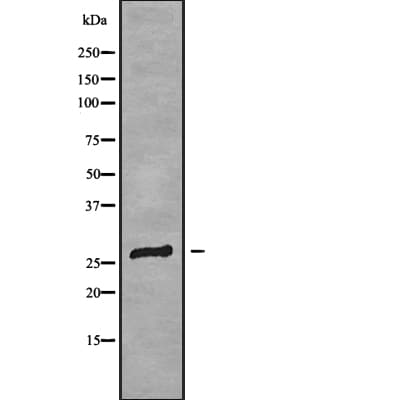 Polyclonal Rabbit anti-Human CLDN18 / Claudin 18 Antibody (WB)
