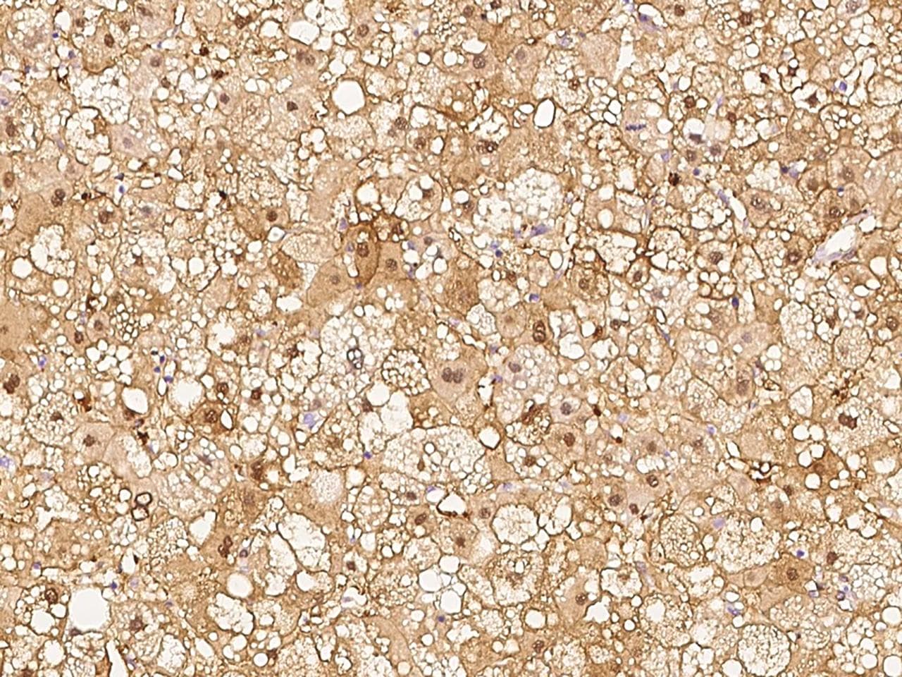 RBKS / Ribokinase Antibody (Preservative Free)