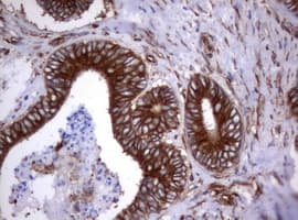 CD30 Antibody (clone OTI16H5)