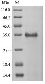 Human CTAG2 Protein (Recombinant 6His-SUMOstar, N-terminus)