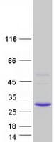 Human SSPN / Sarcospan Protein (Recombinant Myc-DDK (Flag))