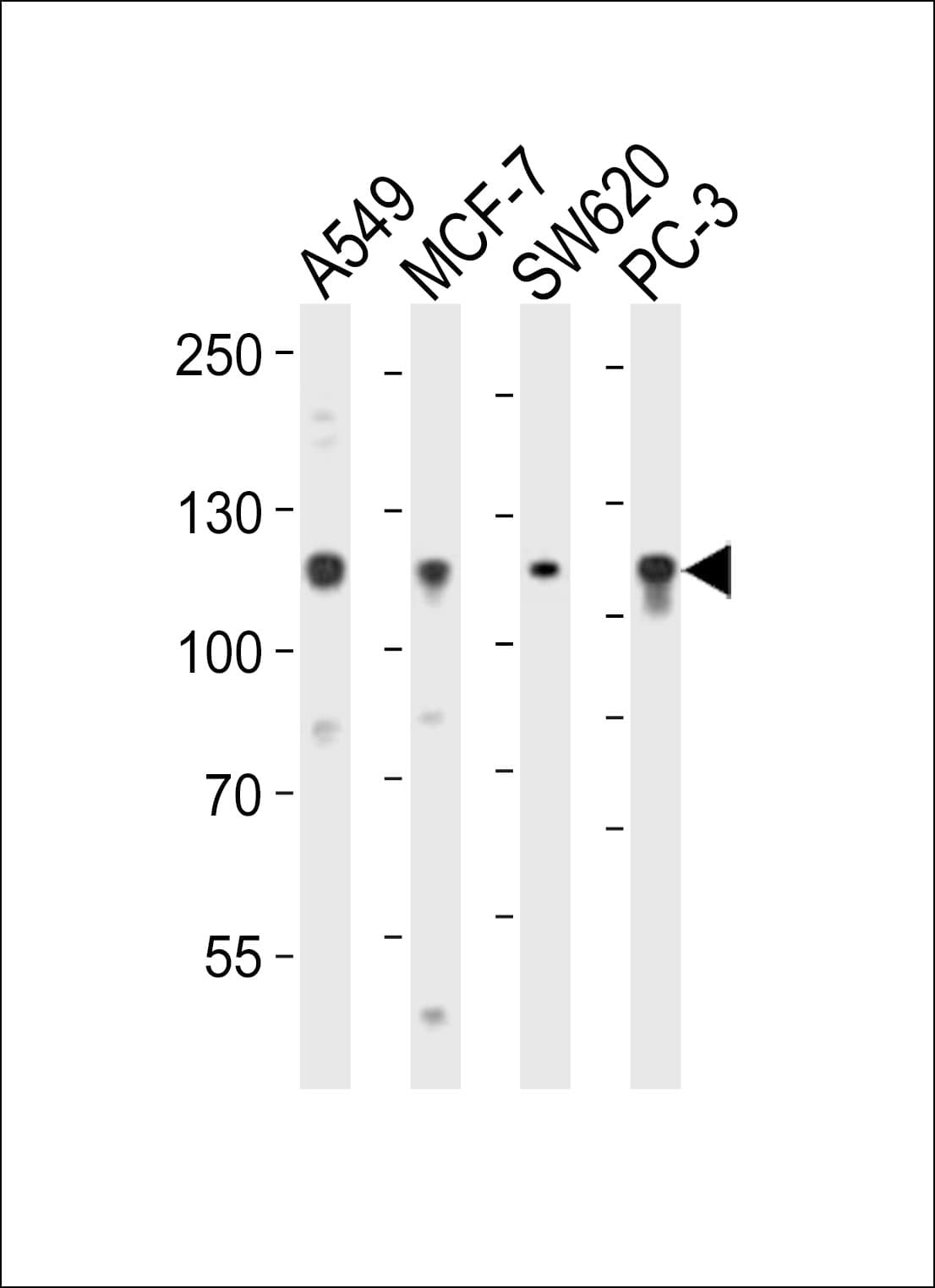 IHC-plus™ GAA / Alpha-Glucosidase, Acid Antibody (aa174-203)