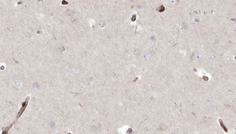 Polyclonal Rabbit anti-Human ABHD5 Antibody (IHC, WB)