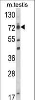 Polyclonal Rabbit anti-Human ELL / MEN Antibody (aa516-545, WB)