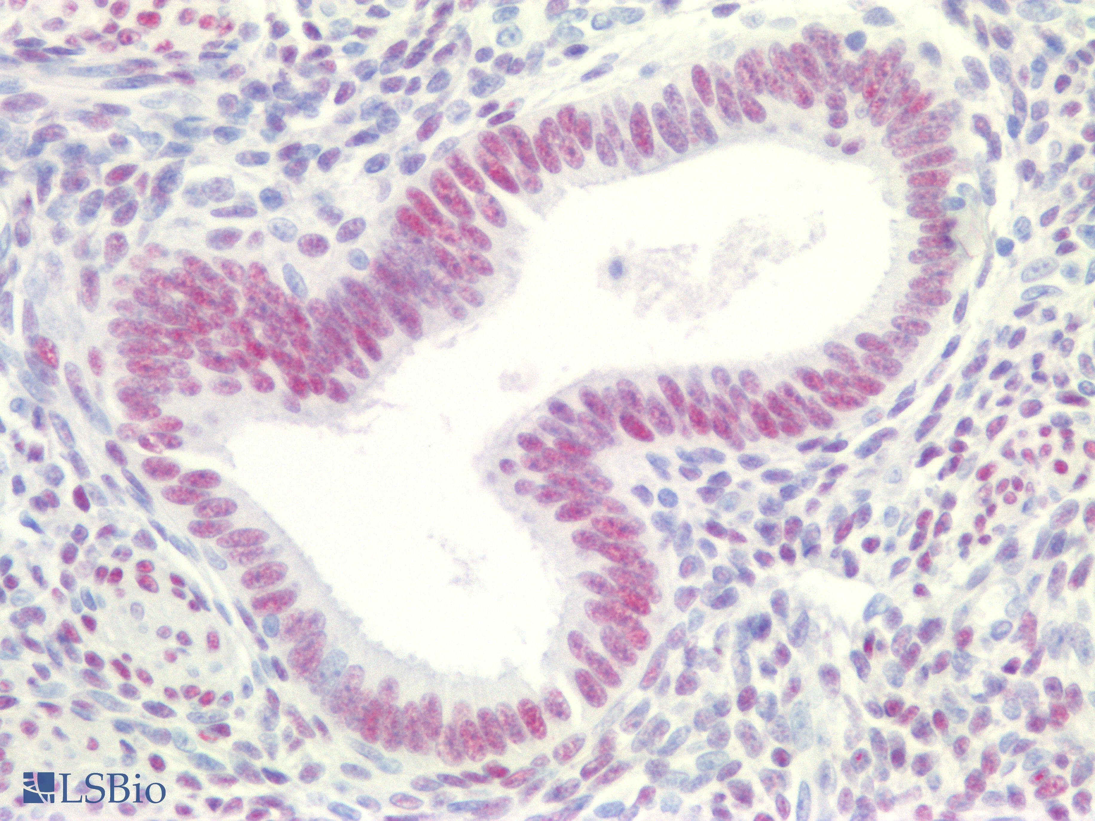 PathPlus™ ER Alpha / Estrogen Receptor Antibody (clone 6F11)