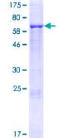 Human CLMP / ACAM Protein (Recombinant GST)