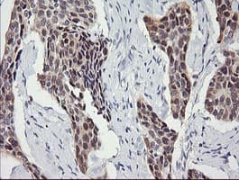 SOLO / SESTD1 Antibody (clone OTI4B10)