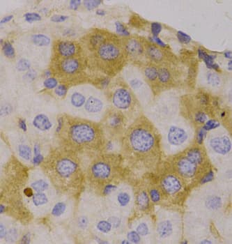 Polyclonal Rabbit anti-Human NBR1 Antibody (IHC, IF, WB)
