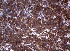 Hamartin / TSC1 Antibody (clone OTI5A8)