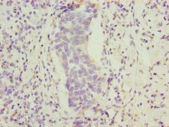FAM222B Antibody