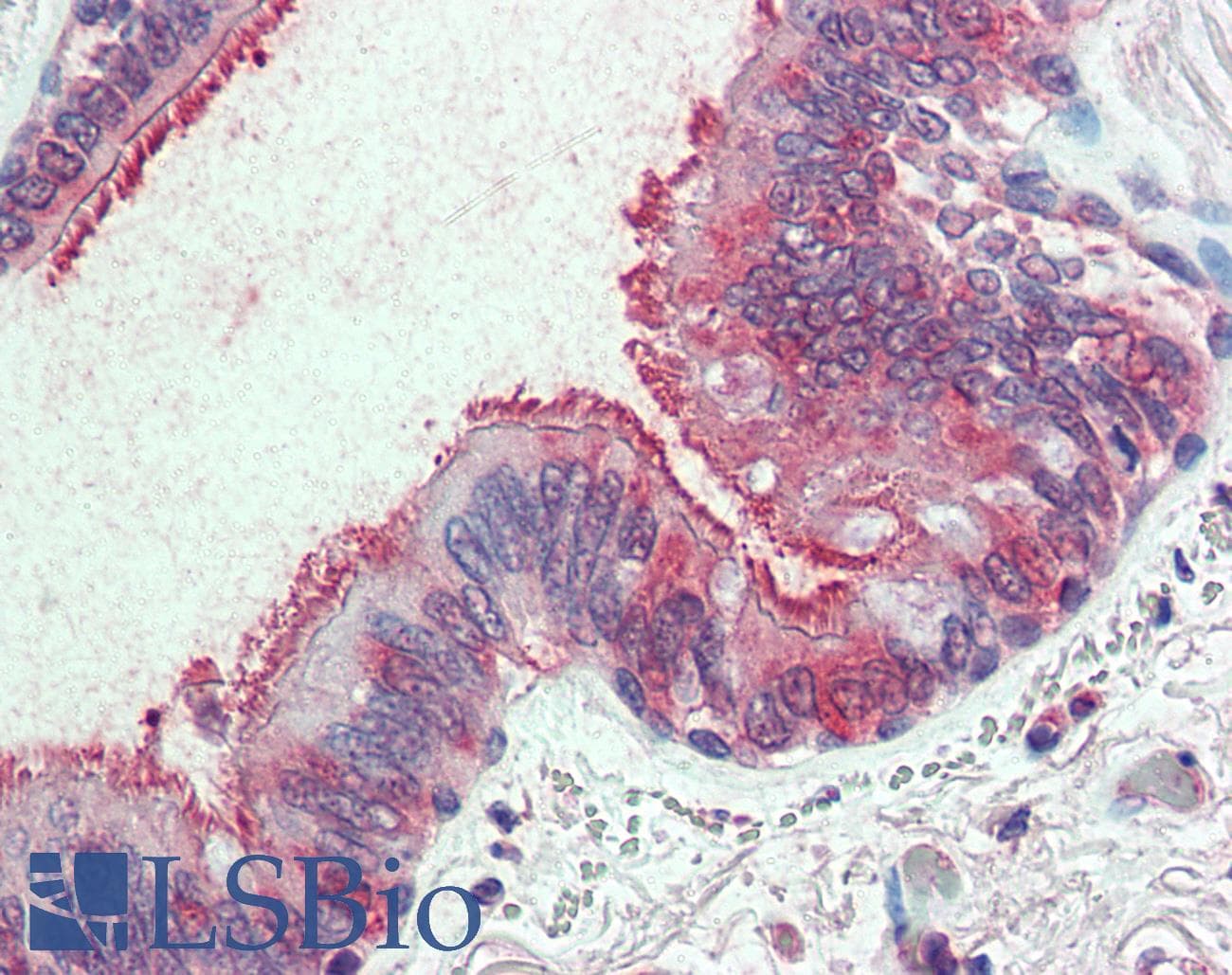 IHC-plus™ SLC44A2 / CTL2 Antibody (Internal)