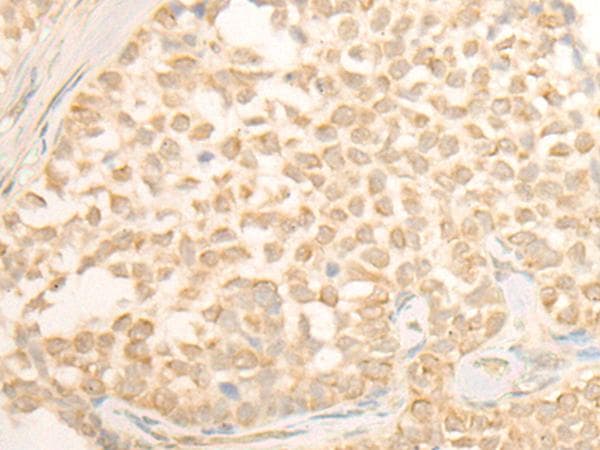 Polyclonal Rabbit anti-Human CYP4X1 Antibody (IHC)