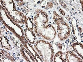 Monoclonal Mouse anti-Human TUBB4 / Tubulin Beta 4 Antibody (clone OTI5C1, IHC, IF, WB)