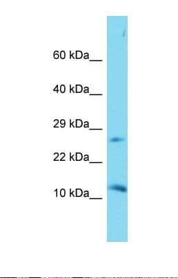 DAPL1 Antibody (N-Terminus)