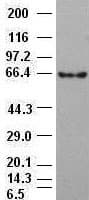 Monoclonal Mouse anti-Human CTNNB1 / Beta Catenin Antibody (clone OTI2H3, WB)