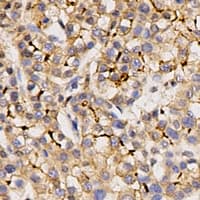Polyclonal Rabbit anti-Human KCND3 / Kv4.3 Antibody (IHC, WB)