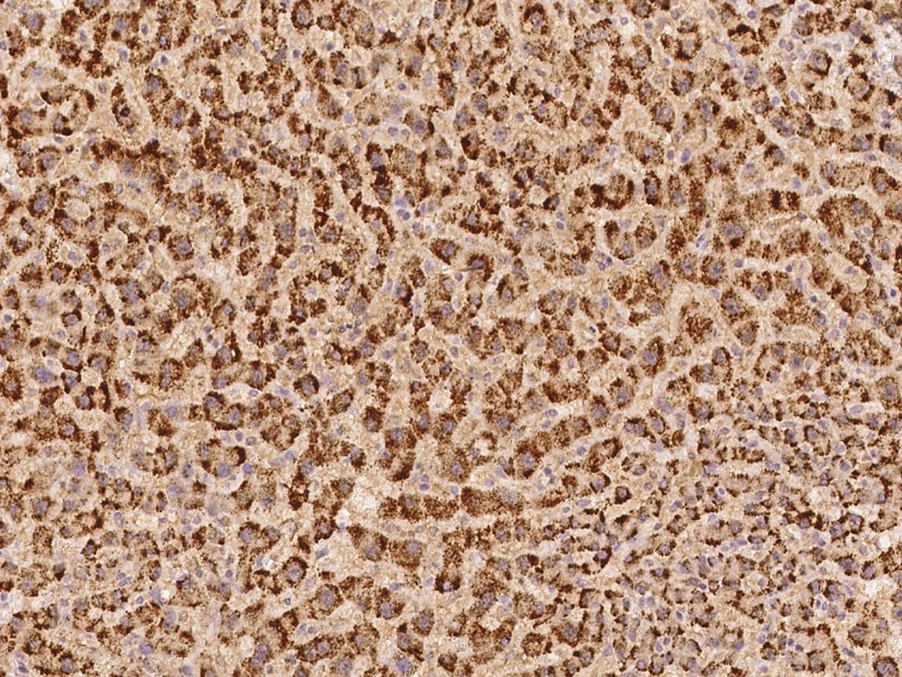 ARHGEF9 / Collybistin Antibody