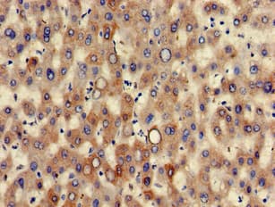KRT7 / CK7 / Cytokeratin 7 Antibody