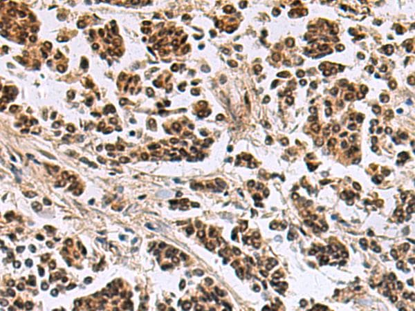 SIK3 / QSK Antibody