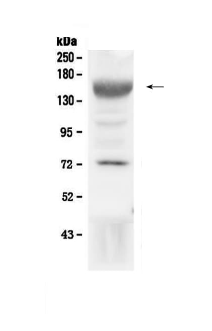 IGF1R / IGF1 Receptor Antibody