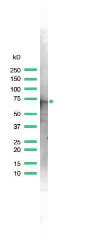 Polyclonal Rabbit anti-Human ANXA6/Annexin A6/Annexin VI Antibody (IHC, WB)