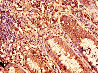 Polyclonal Rabbit anti-Human KRT81 / Keratin 81 / KRTHB1 Antibody