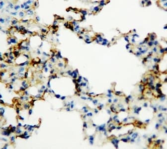AGER / RAGE Antibody (aa174-192)