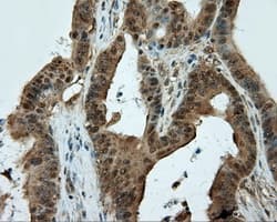 CELF1 / CUGBP1 Antibody (clone OTI5B8)