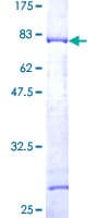 Human SNX15 Protein (Recombinant GST)