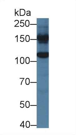 GLDC Antibody (aa81-268)