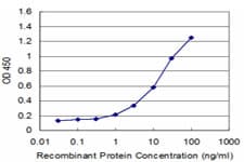 RGS5 Antibody (clone 4E12)