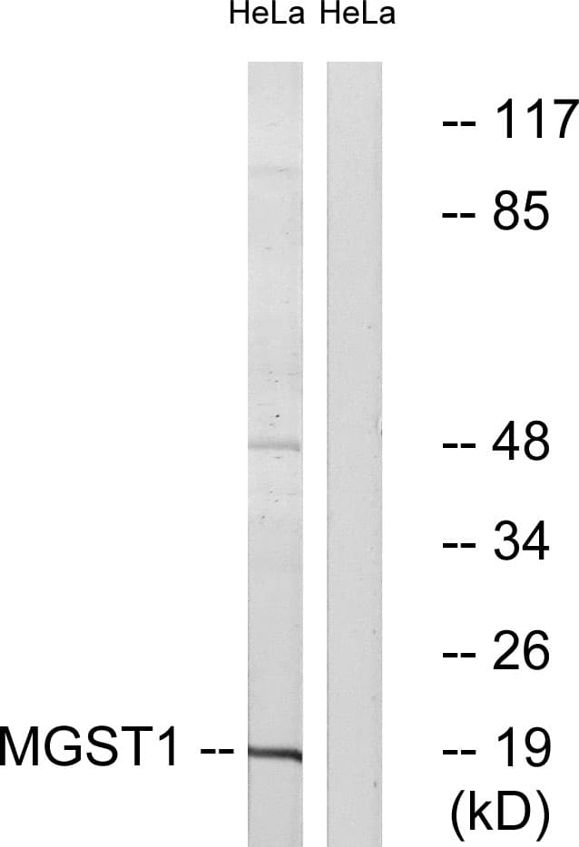 IHC-plus™ Polyclonal Rabbit anti-Human MGST1 Antibody (aa42-91, IHC, WB)