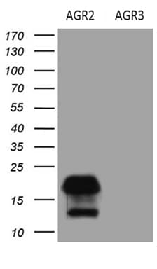 AGR2 Antibody (aa21-175, clone OTI5F1)