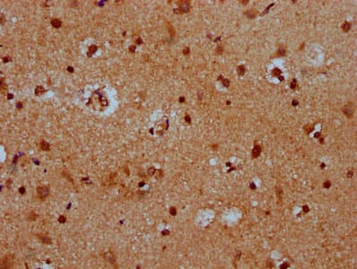 Polyclonal Rabbit anti-Human HES5 Antibody (IHC)