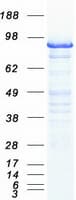 Human MCM3 Protein (Recombinant Myc-DDK (Flag))