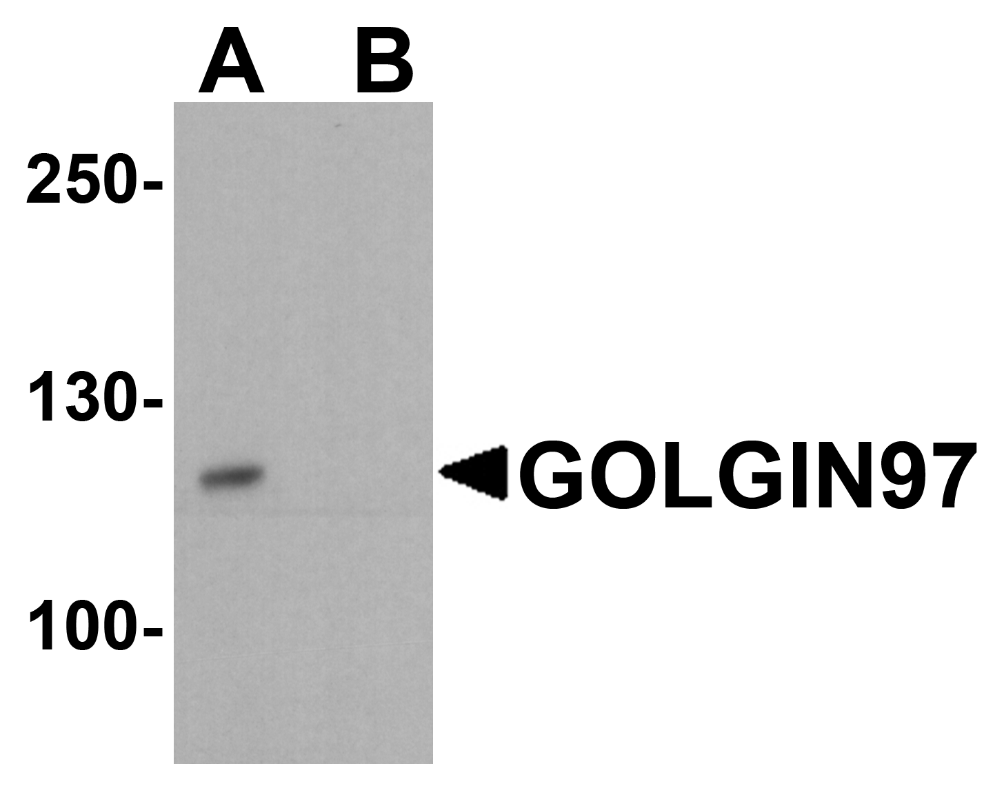 IHC-plus™ GOLGA1 / Golgin-97 Antibody