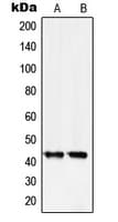 Polyclonal Rabbit anti-Human SERPINB5 / Maspin Antibody (Internal, IHC, IF, WB)