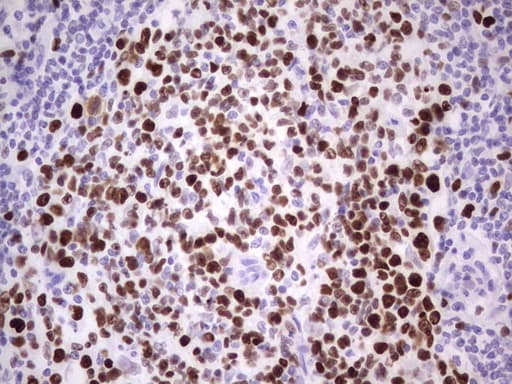 Monoclonal Mouse anti-Human MCM2 Antibody (clone OTI3C12, IHC, WB)