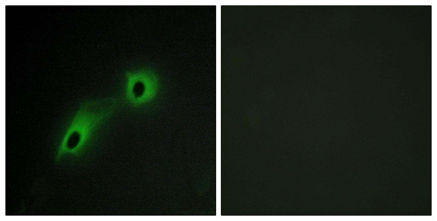 Polyclonal Rabbit anti-Human CAMKV Antibody (IHC, IF, WB)
