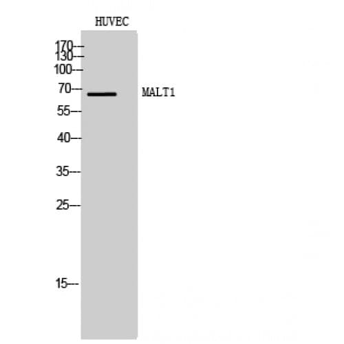 MALT1 Antibody (270-350 aa, Internal)