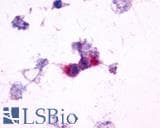 PathPlus™ GRM2 / MGLUR2 Antibody (N-Terminus)