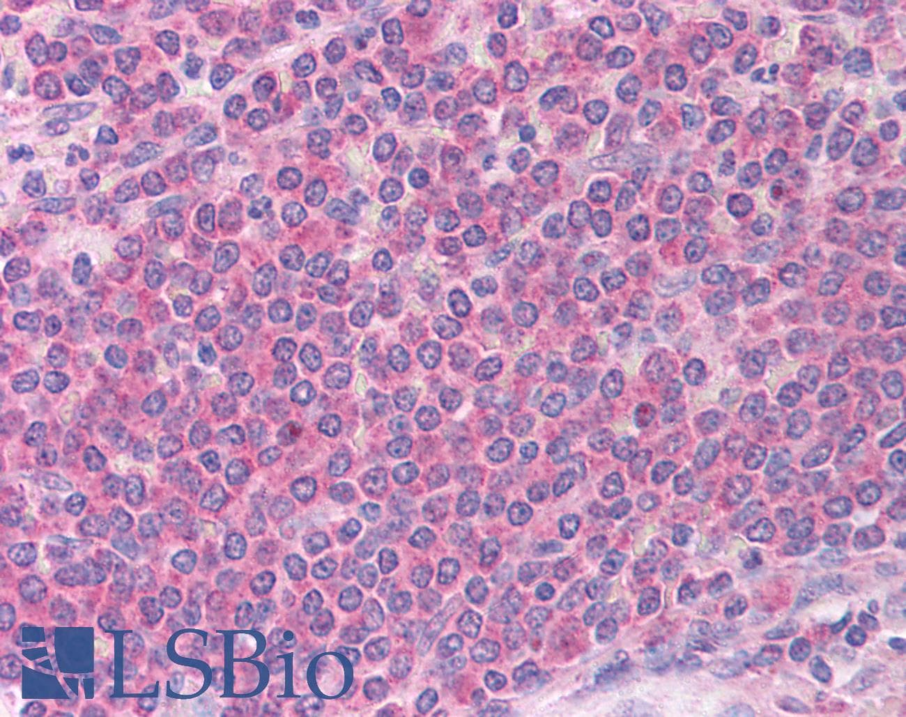 IHC-plus™ Polyclonal Rabbit anti-Human BCL2L11 / BIM Antibody (IHC, IF, WB)