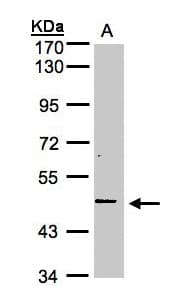 IHC-plus™ Polyclonal Rabbit anti-Human TNFRSF25 / DR3 Antibody (IHC, WB)