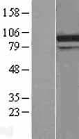 DDX31 Protein (Over-Expression Lysate Myc-DDK (Flag))