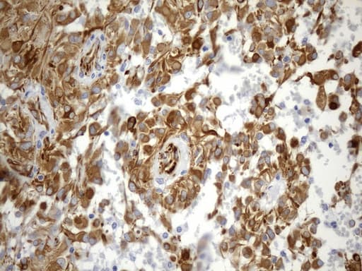 NES / Nestin Antibody (aa99-349, clone UMAB267)